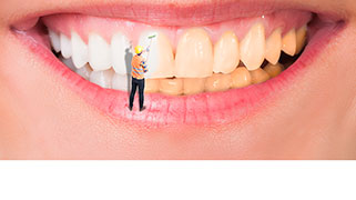 clareamento-dental-estraga-os-dentes