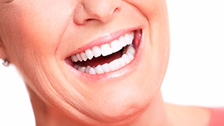 clareamento dental promoção