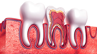 nevralgia dentária tratamento