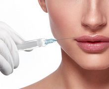 antes e depois preenchimento labial