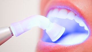 aparelho de clareamento dental a laser