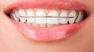 aparelho dental transparente