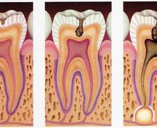 canal dentário
