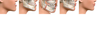 cirurgia de bucomaxilo