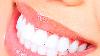 clareamento dental com fita