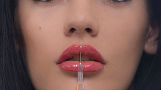 Preenchimento labial preço