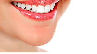 quanto custa clareamento dental caseiro