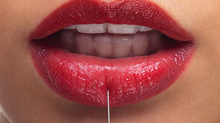 quanto custa preenchimento labial