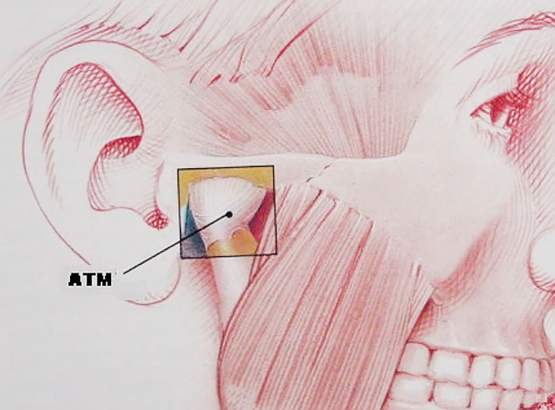 atm mandibular - Consulta Ideal