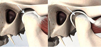 atm-articulacao-temporomandibular