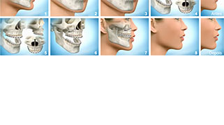Cirurgia buco maxilo