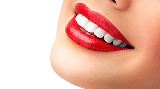 clareamento dental a laser antes e depois