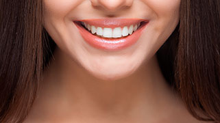 clareamento dental quanto custa