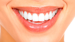 Clareamento dental resina