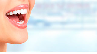 Clareamento dental tipos