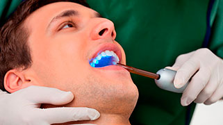 como-fazer-clareamento-dental
