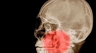 disfuncao-temporomandibular-dor-orofacial