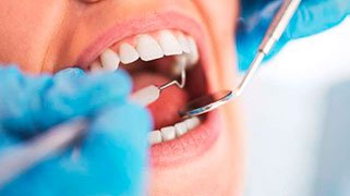 extração dentária