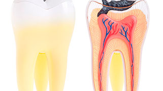 o-que-nevralgia-nos-dentes