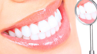 quanto-custa-clareamento-dental