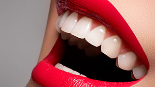 tratamento-clareamento-dental